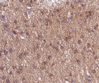 Phospho-NMDAR1 (Ser897) Antibody in Immunohistochemistry (Paraffin) (IHC (P))