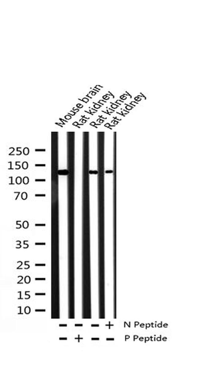 Phospho-NMDAR1 (Ser897) Antibody in Western Blot (WB)