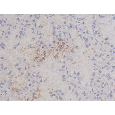 Phospho-Bcl-xL (Thr47) Antibody in Immunohistochemistry (Paraffin) (IHC (P))