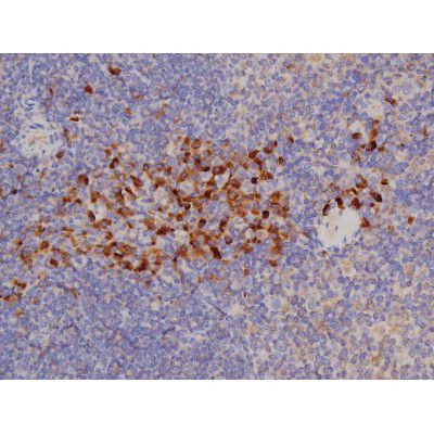 Phospho-Bcl-xL (Thr47) Antibody in Immunohistochemistry (Paraffin) (IHC (P))