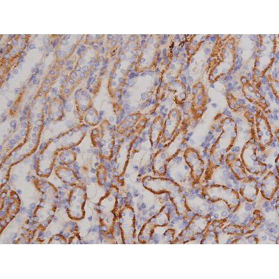 Phospho-Bcl-xL (Thr47) Antibody in Immunohistochemistry (Paraffin) (IHC (P))