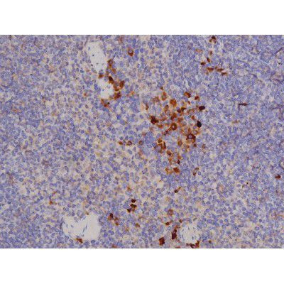 Phospho-Bcl-xL (Thr47) Antibody in Immunohistochemistry (Paraffin) (IHC (P))