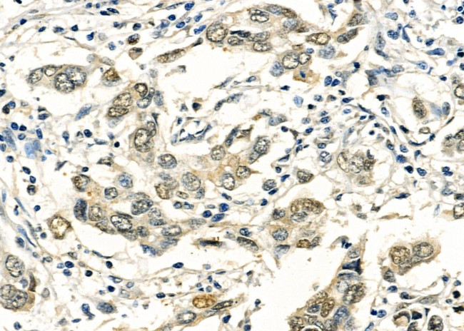 Phospho-FOXO1 (Ser256) Antibody in Immunohistochemistry (Paraffin) (IHC (P))