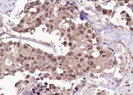 Phospho-FOXO1 (Ser256) Antibody in Immunohistochemistry (Paraffin) (IHC (P))