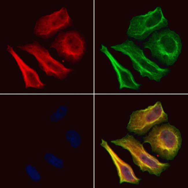 Phospho-FOXO1 (Ser319) Antibody in Immunocytochemistry (ICC/IF)