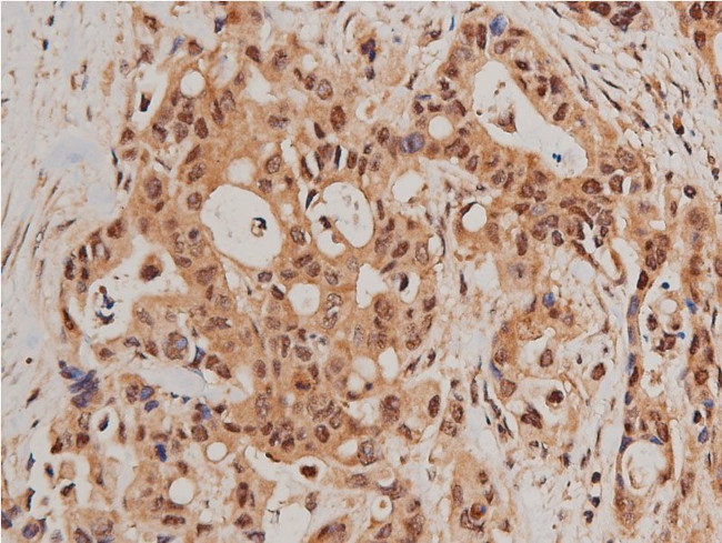 Phospho-FOXO1 (Ser319) Antibody in Immunohistochemistry (Paraffin) (IHC (P))