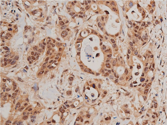 Phospho-FOXO1 (Ser319) Antibody in Immunohistochemistry (Paraffin) (IHC (P))