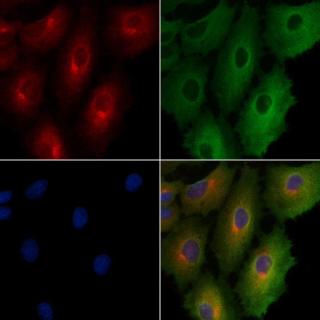 Phospho-Acetyl-CoA Carboxylase (Ser80) Antibody in Immunocytochemistry (ICC/IF)