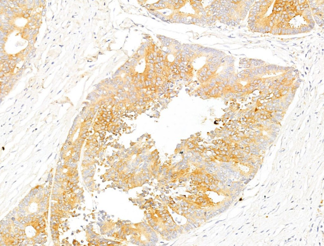 Phospho-Acetyl-CoA Carboxylase (Ser80) Antibody in Immunohistochemistry (Paraffin) (IHC (P))