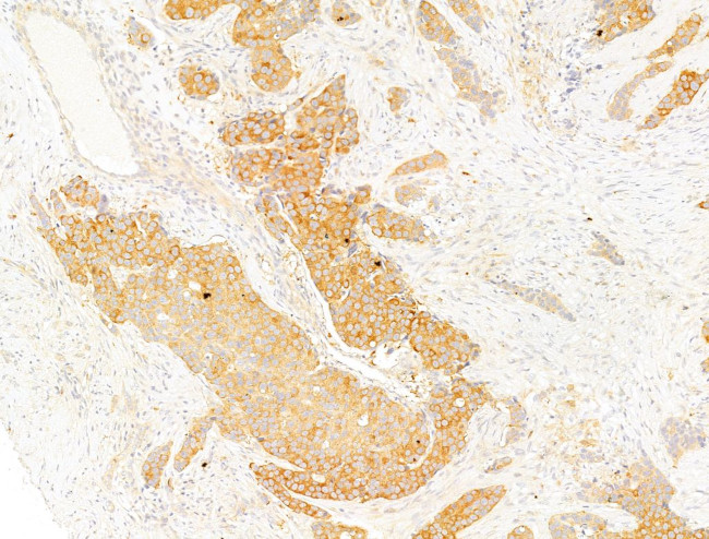 Phospho-Acetyl-CoA Carboxylase (Ser80) Antibody in Immunohistochemistry (Paraffin) (IHC (P))