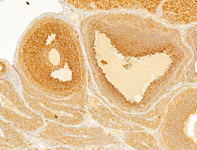 Phospho-Acetyl-CoA Carboxylase (Ser80) Antibody in Immunohistochemistry (Paraffin) (IHC (P))