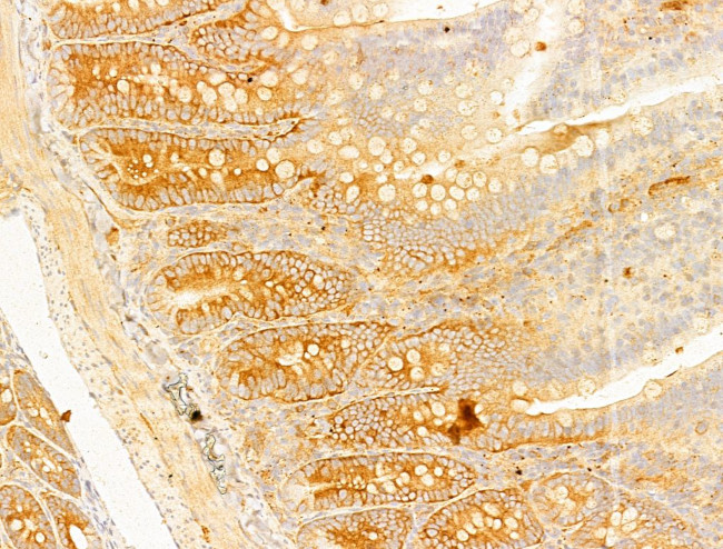 Phospho-Acetyl-CoA Carboxylase (Ser80) Antibody in Immunohistochemistry (Paraffin) (IHC (P))