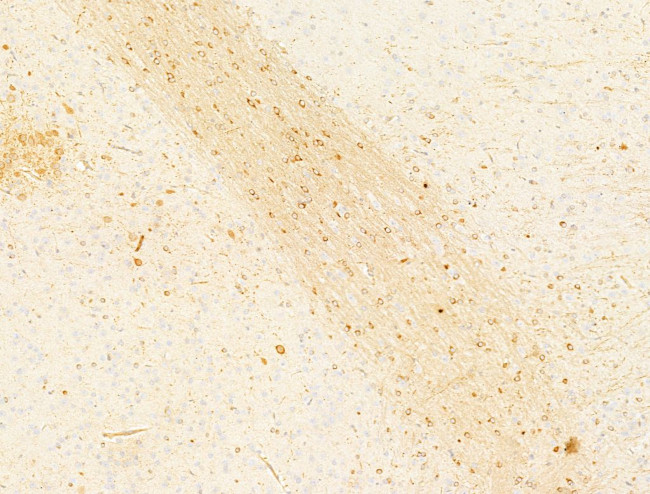 Phospho-Acetyl-CoA Carboxylase (Ser80) Antibody in Immunohistochemistry (Paraffin) (IHC (P))