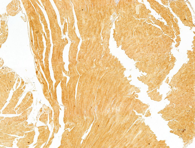 Phospho-Acetyl-CoA Carboxylase (Ser80) Antibody in Immunohistochemistry (Paraffin) (IHC (P))