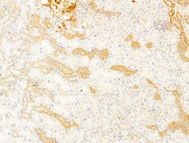 Phospho-Acetyl-CoA Carboxylase (Ser80) Antibody in Immunohistochemistry (Paraffin) (IHC (P))