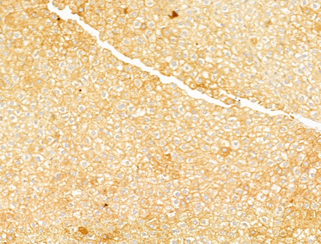 Phospho-Acetyl-CoA Carboxylase (Ser80) Antibody in Immunohistochemistry (Paraffin) (IHC (P))