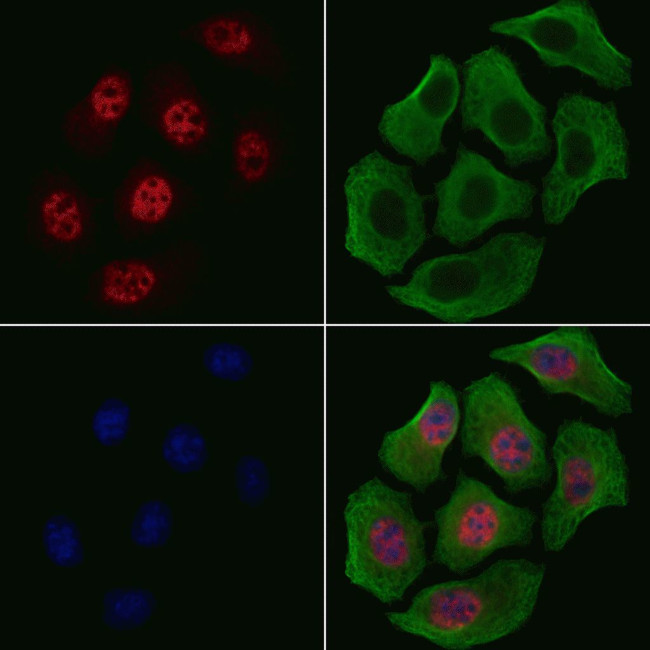 Phospho-AMPK alpha-1 (Ser486) Antibody in Immunocytochemistry (ICC/IF)