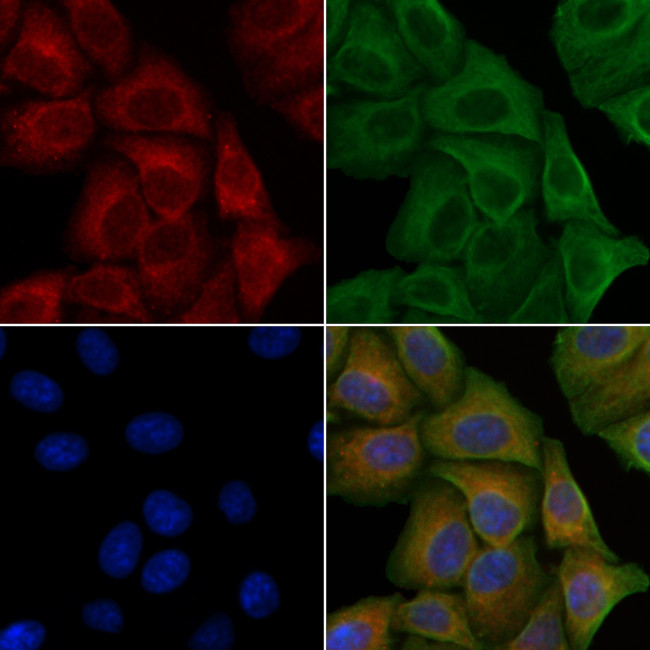 Phospho-PAK1 (Thr212) Antibody in Immunocytochemistry (ICC/IF)