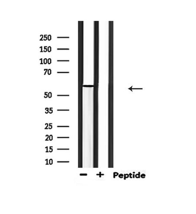 Phospho-PAK1 (Thr212) Antibody in Western Blot (WB)