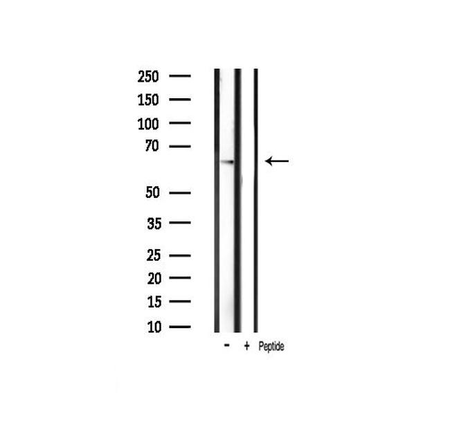 Phospho-PAK1 (Thr212) Antibody in Western Blot (WB)