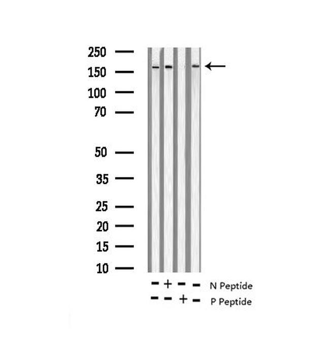Phospho-NMDAR2B (Tyr1474) Antibody in Western Blot (WB)