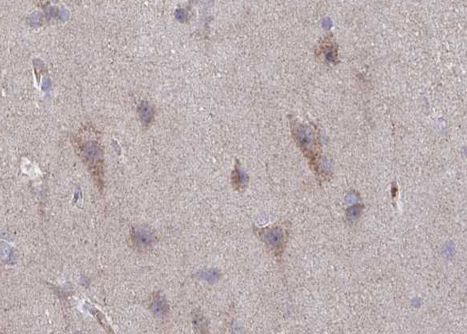 Phospho-NMDAR2B (Tyr1336) Antibody in Immunohistochemistry (Paraffin) (IHC (P))