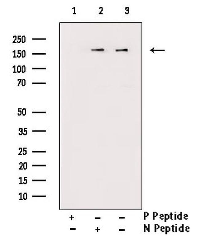 Phospho-NMDAR2B (Tyr1336) Antibody in Western Blot (WB)