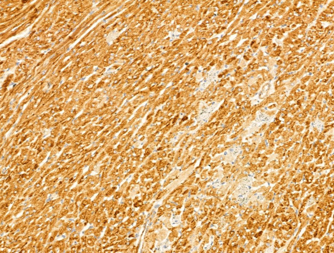 Phospho-CaMKII beta/gamma/delta (Thr287) Antibody in Immunohistochemistry (Paraffin) (IHC (P))