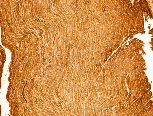 Phospho-CaMKII beta/gamma/delta (Thr287) Antibody in Immunohistochemistry (Paraffin) (IHC (P))