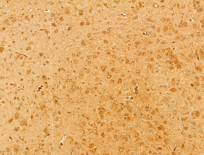 Phospho-CaMKII beta/gamma/delta (Thr287) Antibody in Immunohistochemistry (Paraffin) (IHC (P))