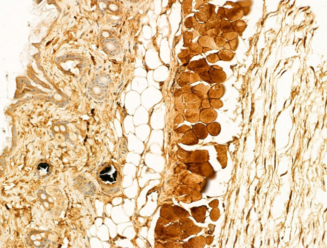 Phospho-CaMKII beta/gamma/delta (Thr287) Antibody in Immunohistochemistry (Paraffin) (IHC (P))