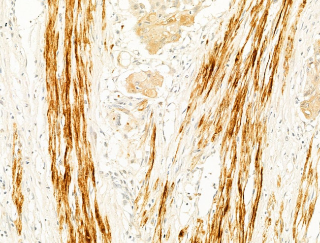 Phospho-CaMKII beta/gamma/delta (Thr287) Antibody in Immunohistochemistry (Paraffin) (IHC (P))