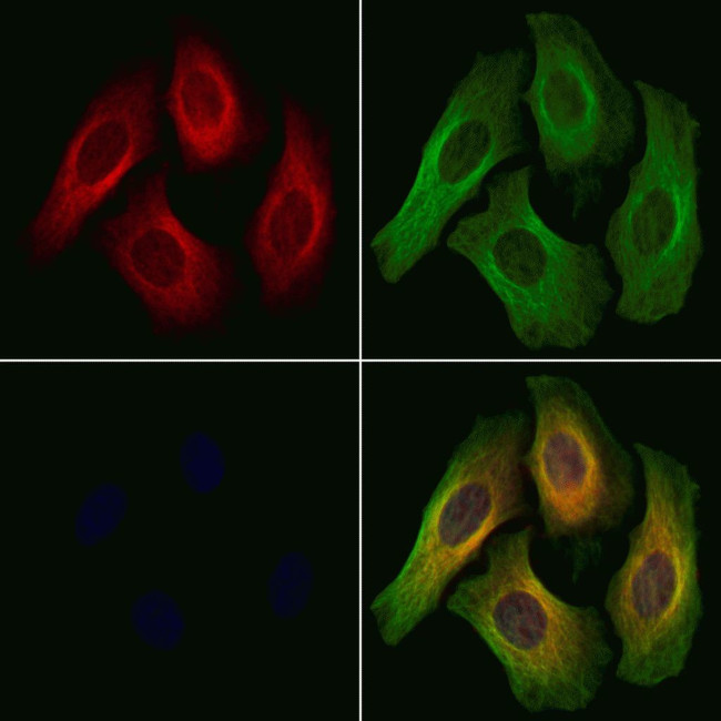 Phospho-PKC mu (Tyr463) Antibody in Immunocytochemistry (ICC/IF)