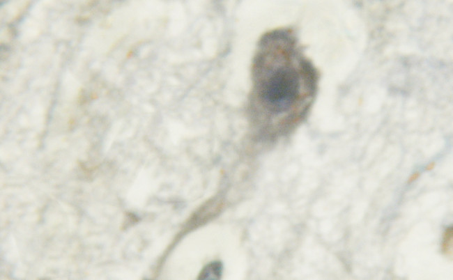 Phospho-PKC mu (Tyr463) Antibody in Immunohistochemistry (IHC)