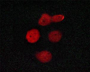 Phospho-TRAP220 (Thr1457) Antibody in Immunocytochemistry (ICC/IF)