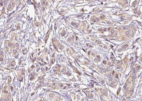 Phospho-TRAP220 (Thr1457) Antibody in Immunohistochemistry (Paraffin) (IHC (P))