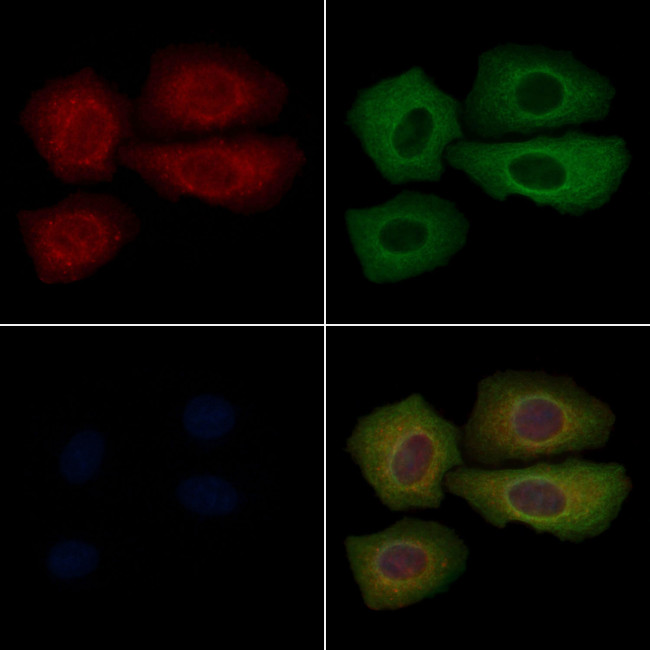 Phospho-IkappaB beta (Ser23) Antibody in Immunocytochemistry (ICC/IF)