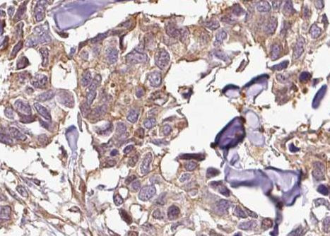 Phospho-IkappaB beta (Ser23) Antibody in Immunohistochemistry (Paraffin) (IHC (P))