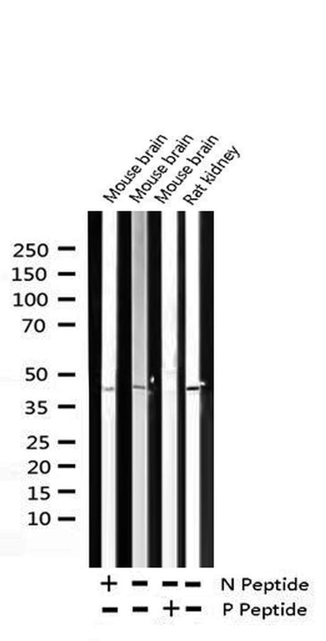 Phospho-IkappaB beta (Ser23) Antibody in Western Blot (WB)