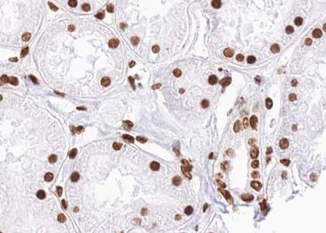 Phospho-SMAD2 (Ser467) Antibody in Immunohistochemistry (Paraffin) (IHC (P))