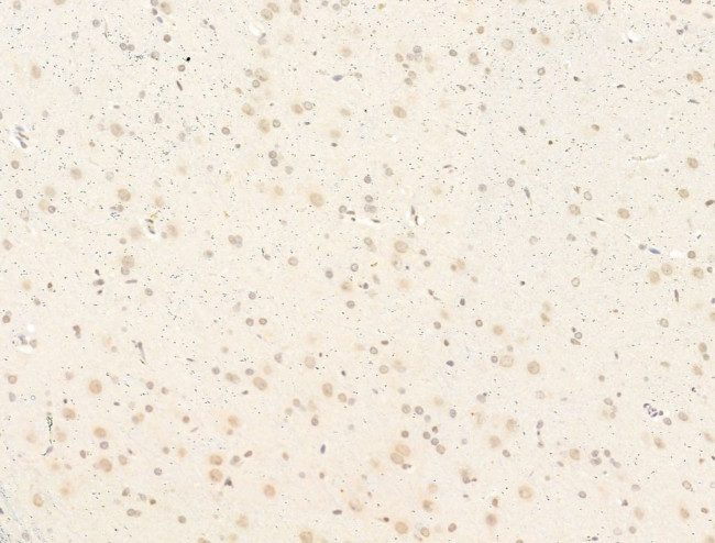 Phospho-SMAD2 (Ser467) Antibody in Immunohistochemistry (Paraffin) (IHC (P))