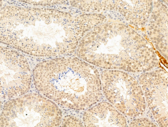 Phospho-SMAD2 (Ser467) Antibody in Immunohistochemistry (Paraffin) (IHC (P))