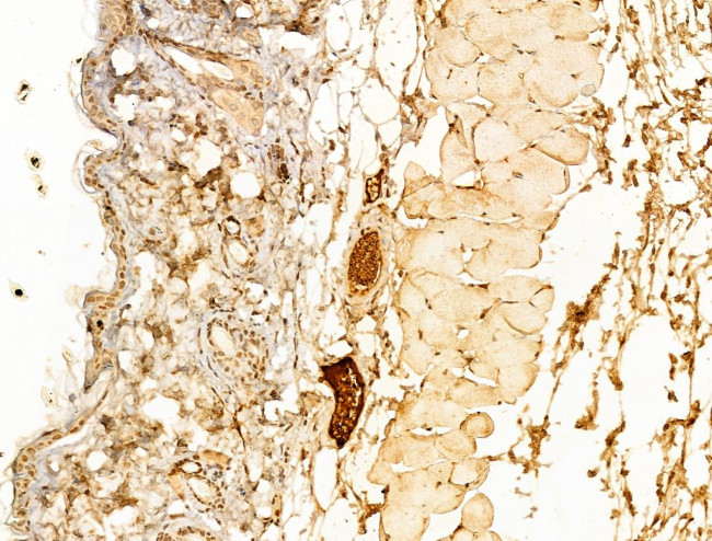 Phospho-SMAD2 (Ser467) Antibody in Immunohistochemistry (Paraffin) (IHC (P))