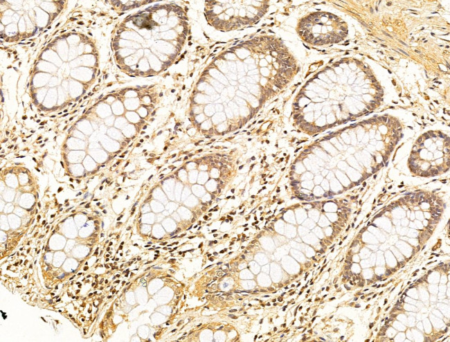 Phospho-SMAD2 (Ser467) Antibody in Immunohistochemistry (Paraffin) (IHC (P))