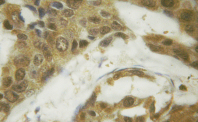 Phospho-SMAD1 (Ser187) Antibody in Immunohistochemistry (Paraffin) (IHC (P))