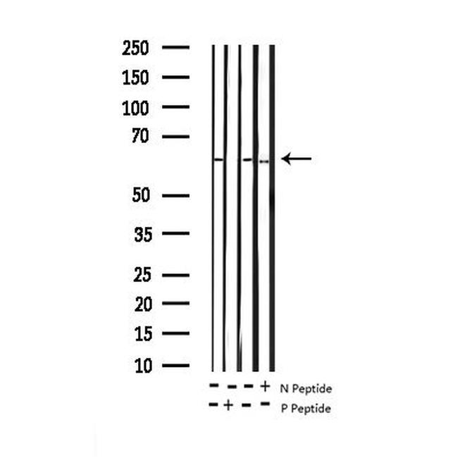 Phospho-SMAD1 (Ser187) Antibody in Western Blot (WB)