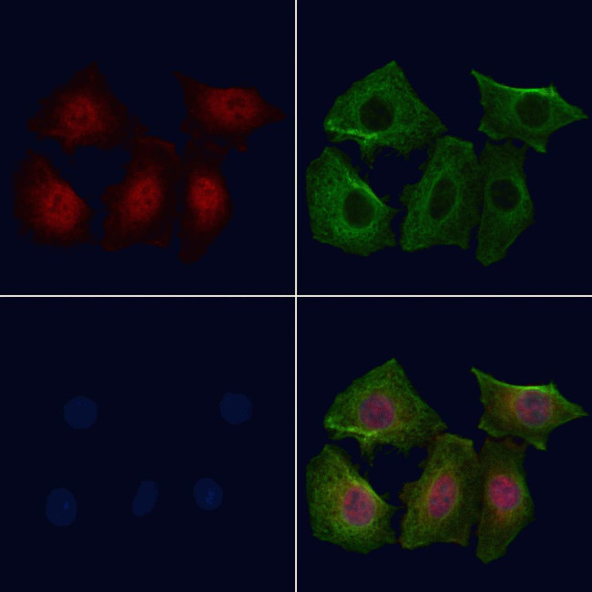 Phospho-p38 MAPK alpha (Tyr323) Antibody in Immunocytochemistry (ICC/IF)