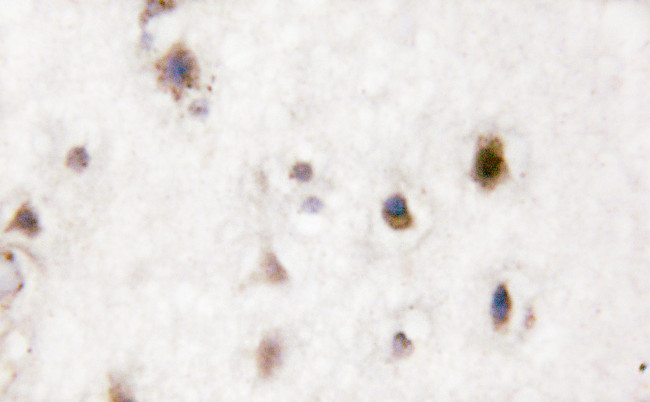 Phospho-p38 MAPK alpha (Tyr323) Antibody in Immunohistochemistry (Paraffin) (IHC (P))