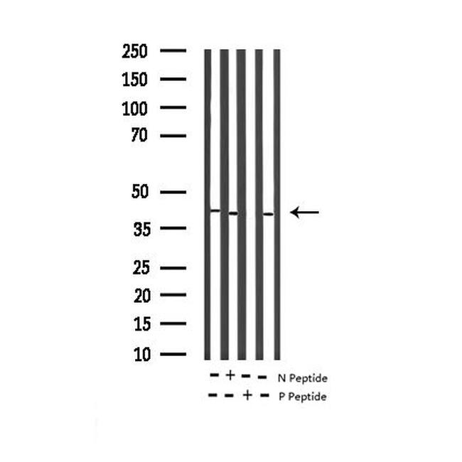 Phospho-p38 MAPK alpha (Tyr323) Antibody in Western Blot (WB)