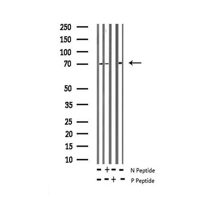 Phospho-CRMP2 (Thr514) Antibody in Western Blot (WB)